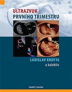 Ultrazvuk prvního trimestru - Ladislav Krofta, kol.
