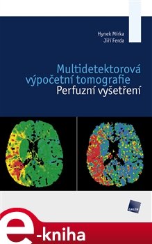 Multidetektorová výpočetní tomografie - Hynek Mírka, Jiří Ferda