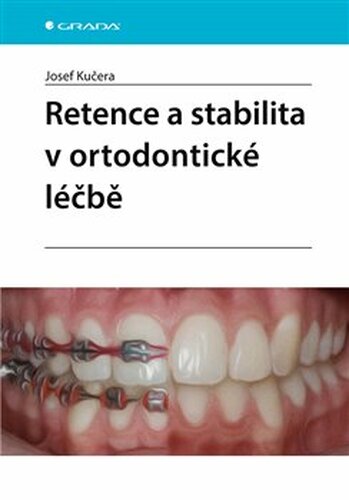 Retence a stabilita v ortodontické léčbě - Josef Kučera