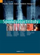 Spondyloartritidy
