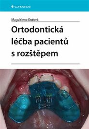 Ortodontická léčba pacientů s rozštěpem
