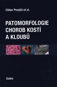 Patomorfologie chorob kostí a kloubů - Ivo Mařík, Alena Maříková, Martin Horák, Ctibor Povýšil